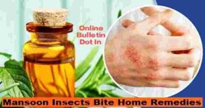 Mansoon Insects Bite Home Remedies
