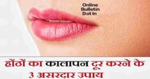 Home Remedies For Lips