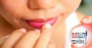 Winter Lip Care Tips
